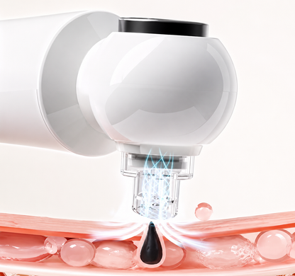 Blackhead Remover PRO